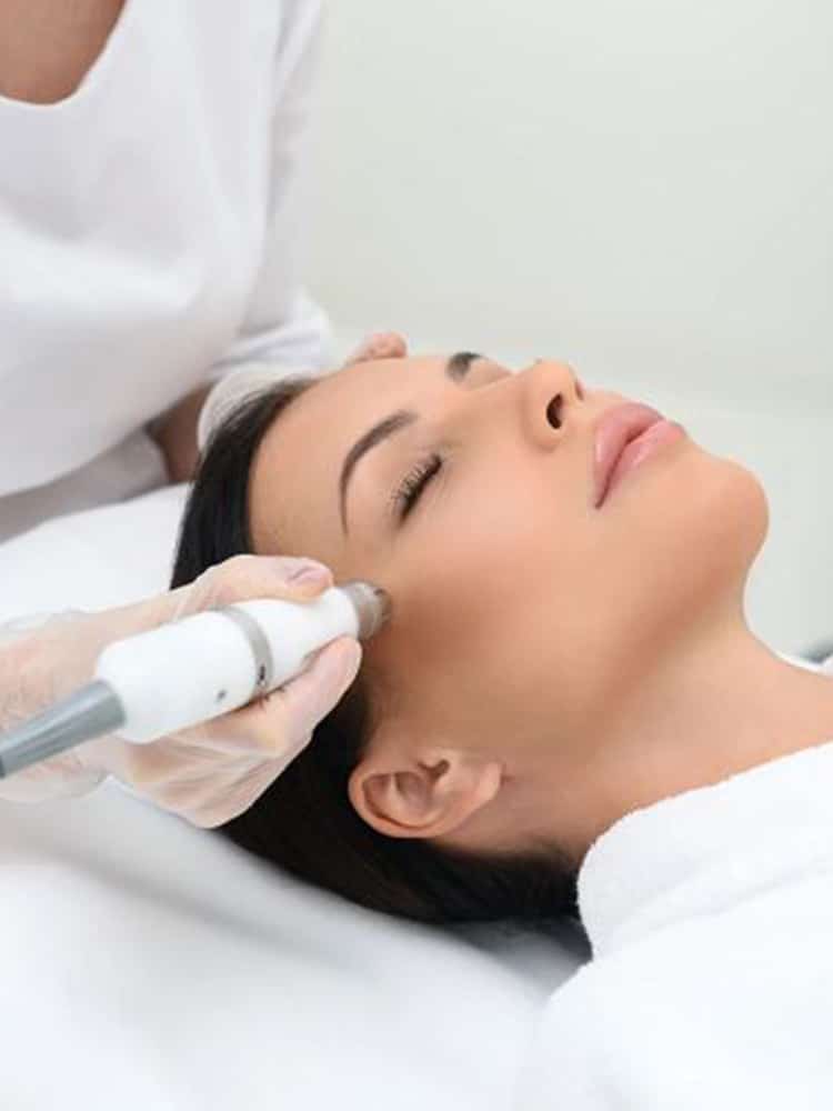 microneedling services
